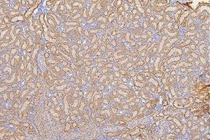 IHC analysis of SFRP1 using anti-SFRP1 antibody (ABIN6719484). (SFRP1 antibody)
