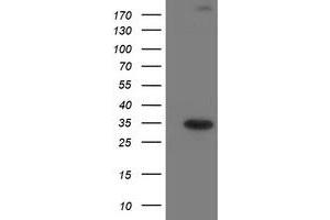 Western Blotting (WB) image for anti-Suppressor of Cytokine Signaling 3 (SOCS3) antibody (ABIN1501055) (SOCS3 antibody)