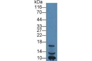 Detection of IGF1 in Human Lymphocyte lysate using Monoclonal Antibody to Insulin Like Growth Factor 1 (IGF1) (IGF1 antibody  (AA 49-118))