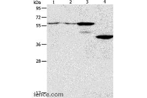 Western blot analysis of A375 and A172 cell, mouse pancreas tissue, human liver cancer tissue, using PGBD2 Polyclonal Antibody at dilution of 1:550