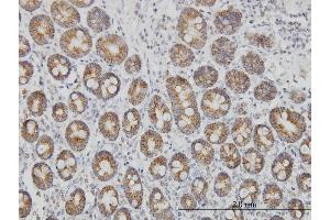 Immunoperoxidase of monoclonal antibody to TOMM20 on formalin-fixed paraffin-embedded human small Intestine. (TOMM20 antibody  (AA 1-145))