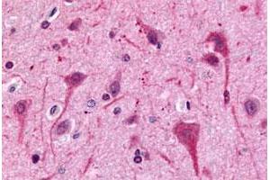 Immunohistochemical (Formalin/PFA-fixed paraffin-embedded sections) staining in human brain, neurons and glia with GPR75 polyclonal antibody . (GPR75 antibody  (C-Term))