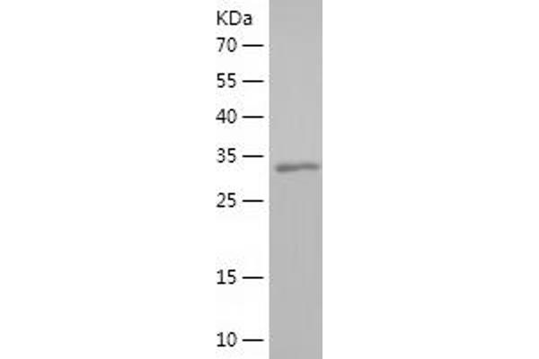 HCRTR1 Protein (AA 1-46, AA 244-297) (His-IF2DI Tag)