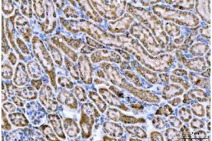 IHC analysis of CPT1A using anti-CPT1A antibody (ABIN7599853).
