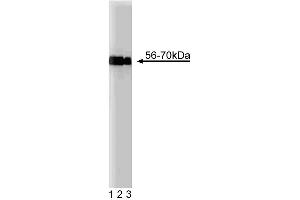 Western blot analysis of MEF2D on a HeLa cell lysate (Human cervical epitheloid carcinoma, ATCC CCL-2. (MEF2D antibody  (AA 346-511))