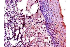 Immunohistochemistry of paraffin-embedded human tonsil tissue using ABIN7172803 at dilution of 1:100 (TACC3 antibody  (AA 133-268))