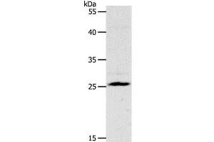 Western Blot analysis of Mouse liver tissue using NQO2 Polyclonal Antibody at dilution of 1:1200 (NQO2 antibody)