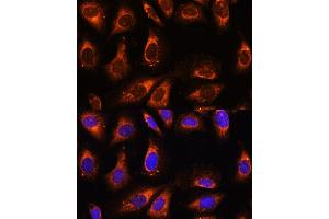 Immunofluorescence analysis of U-2 OS cells using RPL26 antibody (ABIN7269999) at dilution of 1:100. (RPL26 antibody  (AA 20-95))