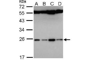 WB Image Sample (30 ug of whole cell lysate) A: Hela B: Hep G2 , C: Molt-4 , D: Raji 12% SDS PAGE antibody diluted at 1:5000 (FAM9B antibody)