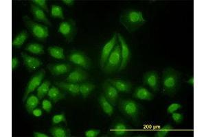 Image no. 3 for anti-Tyrosine Kinase 2 (TYK2) (AA 276-375) antibody (ABIN598992) (TYK2 antibody  (AA 276-375))