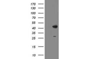 Western Blotting (WB) image for anti-Dihydrolipoamide Branched Chain Transacylase E2 (DBT) antibody (ABIN1497771) (DBT antibody)