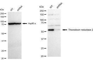 anti-Thioredoxin Reductase 2 (TXNRD2) antibody