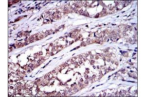 Immunohistochemistry (IHC) image for anti-Proto-oncogene tyrosine-protein kinase Src (Src) antibody (ABIN969418)