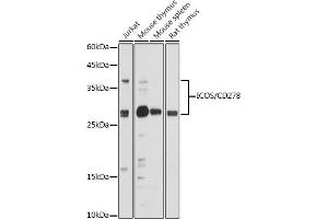 Western Blotting (WB) image for anti-Inducible T-Cell Co-Stimulator (ICOS) (AA 21-140) antibody (ABIN3022591)