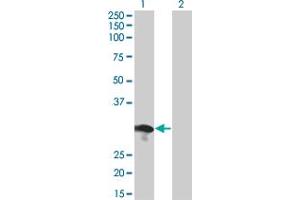 Western Blot analysis of RABL2B expression in transfected 293T cell line by RABL2B monoclonal antibody (M01), clone 1B10. (RABL2B antibody  (AA 1-229))