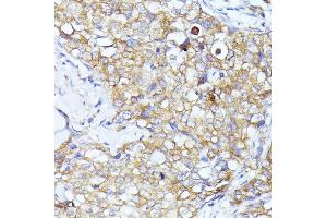 Immunohistochemistry (IHC) image for anti-Eukaryotic Translation Initiation Factor 3, Subunit L (EIF3L) (AA 1-230) antibody (ABIN6140074)