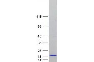 Western Blotting (WB) image for Transcription Elongation Factor B (SIII), Polypeptide 2 (18kDa, Elongin B) (TCEB2) (Transcript Variant 1) protein (Myc-DYKDDDDK Tag) (ABIN2733350)