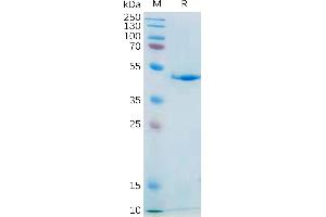 Human IL21 Protein, mFc Tag on SDS-PAGE under reducing condition. (IL-21 Protein (AA 30-162) (mFc Tag))