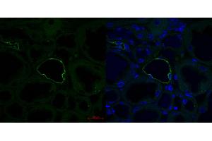 Mouse kidney (AQP2 antibody  (Middle Region))