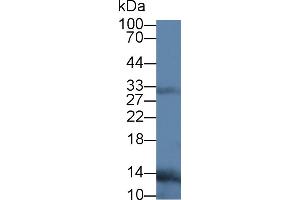 Western Blot; Sample: Human Leukocyte lysate; Primary Ab: 3µg/ml Mouse Anti-Human RANkL Antibody Second Ab: 0. (RANKL antibody  (AA 106-240))