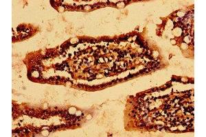 Immunohistochemistry of paraffin-embedded human small intestine tissue using ABIN7157063 at dilution of 1:100 (HSCB antibody  (AA 30-235))