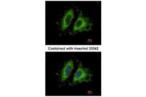 ICC/IF Image Immunofluorescence analysis of methanol-fixed HeLa, using GIT1, antibody at 1:500 dilution. (GIT1 antibody  (Internal Region))