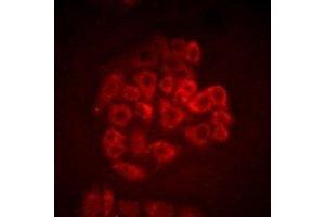 Immunofluorescent analysis of BOC staining in SW480 cells. (BOC antibody)