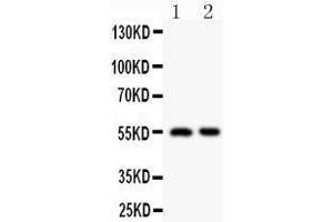 Anti-HDAC2 antibody,  Western blotting All lanes: Anti HDAC2 () at 0. (HDAC2 antibody  (C-Term))