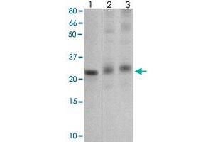 The tissue/cell lysate derived from mouse liver (Lane 1), mouse muscle (Lane 2) and MCF-7 (Lane 3) were immunoprobed by SOCS1 polyclonal antibody  at 1 : 500. (SOCS1 antibody  (C-Term))