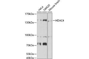 Western blot analysis of extracts of various cell lines, using HD antibody (ABIN6133741, ABIN6141671, ABIN6141674 and ABIN6223957) at 1:1000 dilution. (HDAC4 antibody  (AA 1-100))