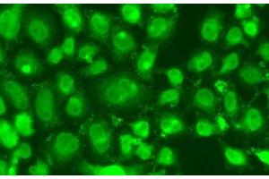 Immunofluorescence analysis of A549 cells using TSEN2 Polyclonal Antibody (TSEN2 antibody)