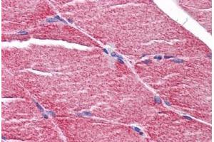 Human Skeletal Muscle: Formalin-Fixed, Paraffin-Embedded (FFPE) (MYBPC2 antibody  (C-Term))