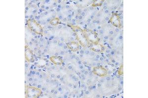 Immunohistochemistry of paraffin-embedded mouse kidney using MRPS30 Antibody. (MRPS30 antibody  (AA 190-439))