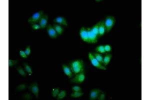 Immunofluorescence staining of HepG2 cells with ABIN7150368 at 1:333, counter-stained with DAPI. (Id2 antibody  (AA 1-134))