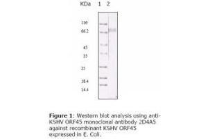 Image no. 1 for anti-HHV-8 ORF45 antibody (ABIN478369) (HHV-8 ORF45 antibody)