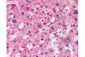 Immunohistochemistry (IHC) image for anti-Arginase, Liver (ARG1) (N-Term) antibody (ABIN2782309) (Liver Arginase antibody  (N-Term))