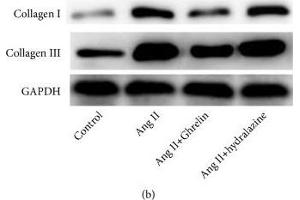 Ghrelin lowered systolic blood pressure and collagen I and collagen III protein expression in the myocardium of Ang II-infused rats. (GAPDH antibody  (AA 1-335))