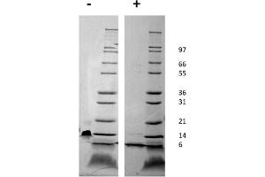SDS-PAGE of Mouse Stromal Cell-Derived Factor-1 alpha (CXCL12) Recombinant Protein SDS-PAGE of Mouse Stromal Cell-Derived Factor-1 alpha (CXCL12) Recombinant Protein. (CXCL12 Protein)