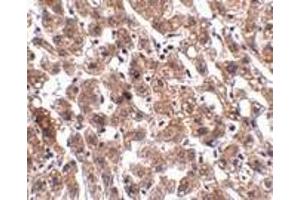 Immunohistochemistry of HAAO in human liver tissue with HAAO antibody at 2. (HAAO antibody  (N-Term))