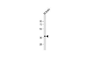Anti-RASSF2 Antibody (N-Term)at 1:2000 dilution + mouse brain lysates Lysates/proteins at 20 μg per lane. (RASSF2 antibody  (AA 64-98))