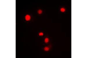 Immunofluorescent analysis of SP1 (pT453) staining in Jurkat cells. (SP1 antibody  (pSer453))