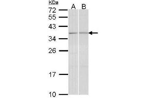 WB Image Sample (30 ug of whole cell lysate) A: A431 , B: Hela 12% SDS PAGE antibody diluted at 1:1000 (TGIF2 antibody  (C-Term))