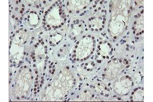 Image no. 6 for anti-SEC14 and Spectrin Domains 1 (SESTD1) antibody (ABIN1501066) (SESTD1 antibody)