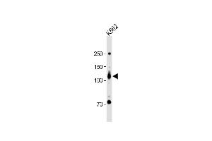 ROR2 antibody  (N-Term)