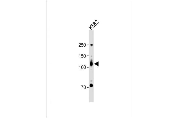 ROR2 antibody  (N-Term)