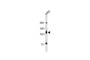 All lanes : Anti-ROR2 Antibody (N-term) at 1:1000 dilution + K562 whole cell lysate Lysates/proteins at 20 μg per lane. (ROR2 antibody  (N-Term))