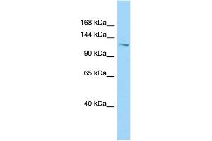 WB Suggested Anti-PKD1L1 Antibody Titration: 1. (PKD1L1 antibody  (N-Term))