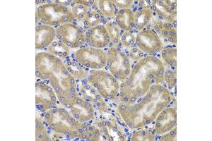 Immunohistochemistry of paraffin-embedded mouse kidney using NLRC4 antibody at dilution of 1:100 (x400 lens). (NLRC4 antibody)