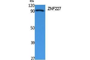 Western Blotting (WB) image for anti-Zinc Finger Protein 227 (ZNF227) (Internal Region) antibody (ABIN3178116) (ZNF227 antibody  (Internal Region))