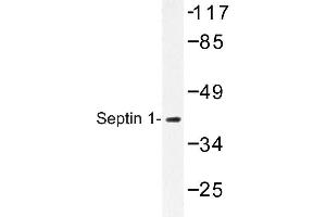 Image no. 1 for anti-Septin 1 (SEPT1) antibody (ABIN272245) (Septin 1 antibody)